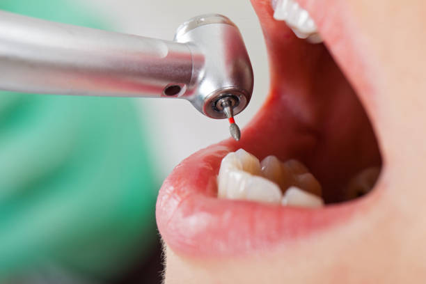 Best Cracked Tooth Emergency Dentist  in Watervliet, MI
